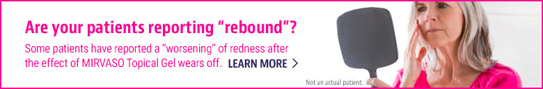 rebound